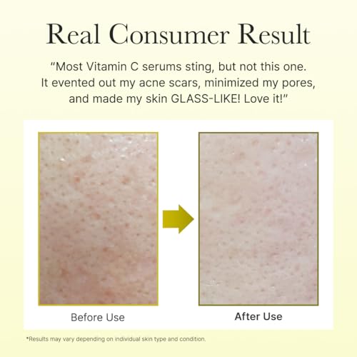 Image of Arencia Vitamin C Booster Serum with Glutathione, Niacinamide, and Vitamin E 30mL | Korean Cosmetics | Skincare Serum | Improves Skin Tone and Radiance