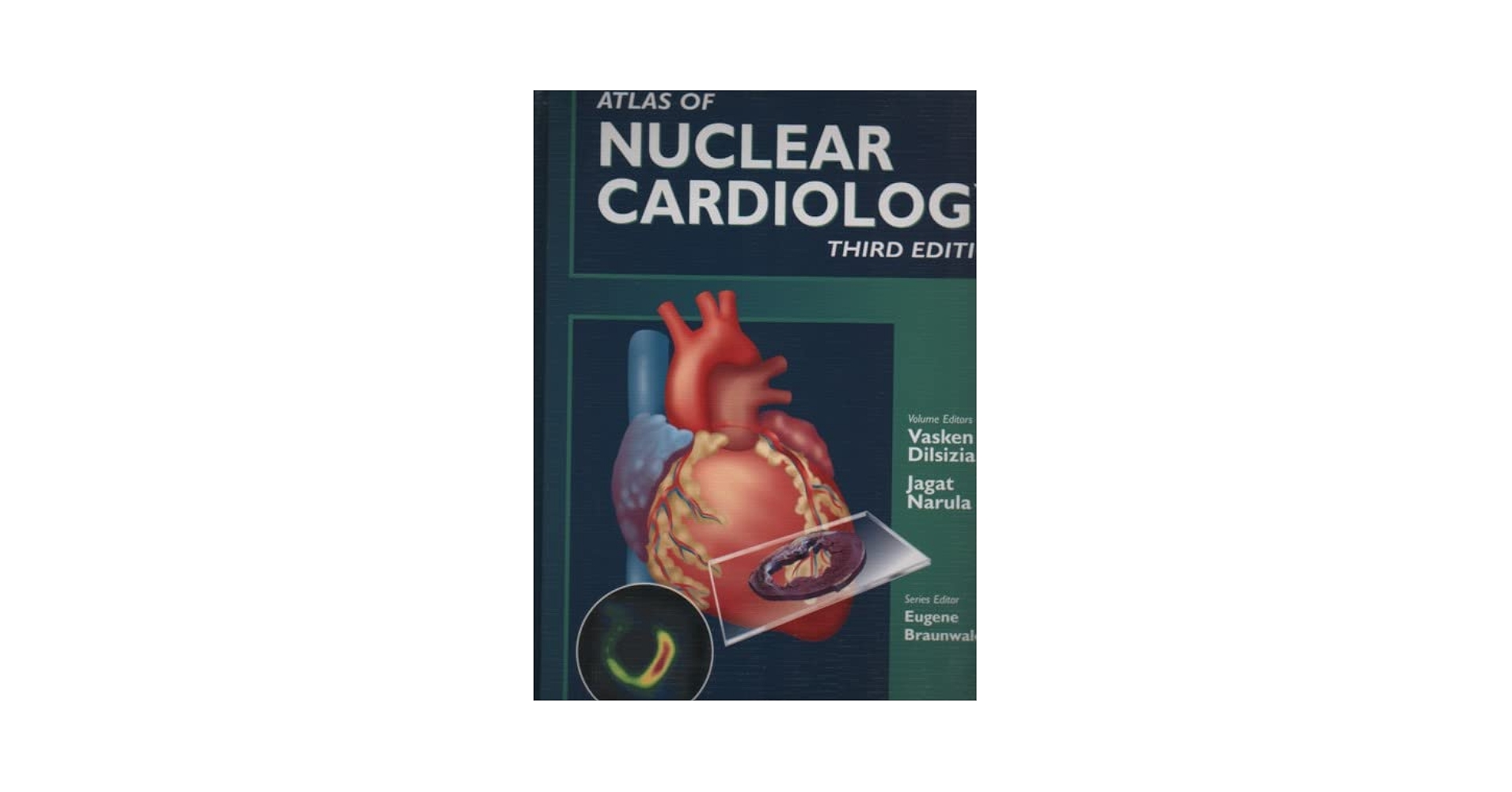 洋書 Atlas of Nuclear Cardiology 2nd edition Amazon.com: Atlas of Nuclear Cardiology: 9781573403030