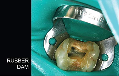 SURGICAL ONLINE (Lot of 3) Endodontic Rubber Dam Clamps # 206