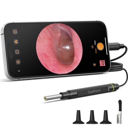 ScopeAround Otoscope with Light, 1080P FHD Ear Scope, 3.9mm Digital Otoscope Camera with 6 LED Lights Ear Wax Removal Tool Camera, Ear Scope with Light, Compatible with iPhone15 & Android