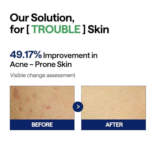 MEDIHEAL Teatree Trouble Pad - Square Cotton Facial Toner Pads with Tea Tree & Lactobacillus - Soothing Pads to Calm Sensitive & Acne Prone Skin- Vegan Face Gauze Pads, 100 Pads