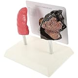 HOODANCOS Pvc Lungenmodell für Unterricht mit Realistischer Darstellung und Pathologischer Raucherlunge Anatomisches Modell für Anatomie und Physiologieunterricht