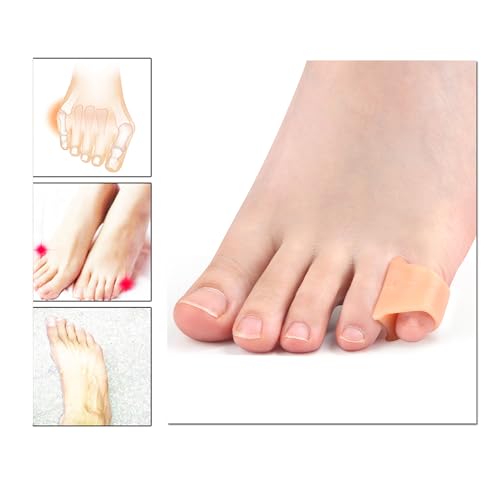 Image of 10 Pcs Pinky Toe Splint, Gel Toe Separators, Little Toe Straightener Hammer Toe for Men Women Walking, Running, Overlapping, Bunion Corrector and Bunion Relief