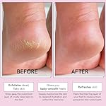 grace & stella Award-Winning Foot Peel Mask - Foot Peeling Mask with Aloe Vera - Moisturizing Foot Mask for Dry Cracked Feet - Foot Exfoliator for Baby Soft Feet (4 Pairs, Lavender) - Image 3
