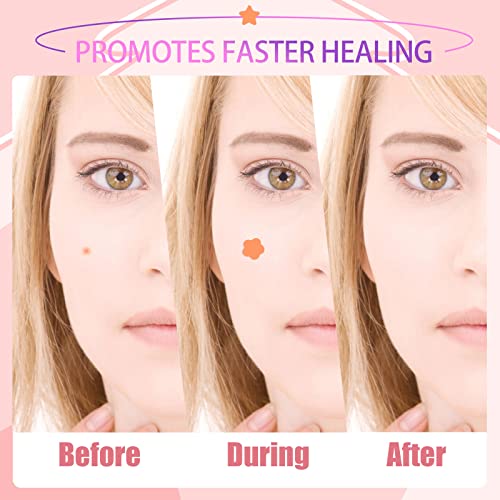 Pimple Patch, Hydrokolloid Pickel Patch, 148 Counts Acne Patch, Pickel Pflaster Unsichtbar für Gesicht Anti Akne Hautbehandlung