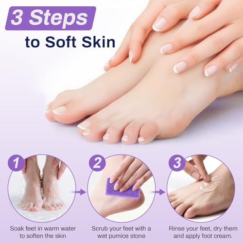 image for RAQEHO 20 Small Pumice Stone for Feet - 3.6 X 1.8 X 0.47 Inch Purple F