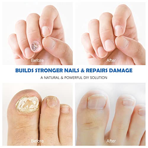 Pulchra Nail Repair Pen, Fingernails And Toenails Care Solution With Nail File - Hydrates, Restore And Nourish Discoloration, Brittle, Ridged And Damaged Nails (2 Pcs) #TOP4