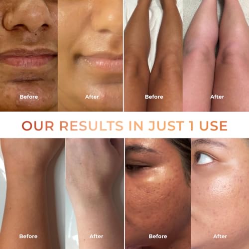 Image of NICONI Tan Vanish Gluta-Kojic Skin Polish | Instant Tan Removal & Glow | Infused with Kojic Acid & Glutathione | Ideal for All Skin Types | Lightens Suntan | 180g