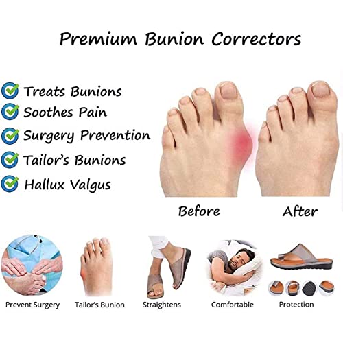 Vintage Bunion Corrector Mens Sandals,Elegant PU Lightweight Non-Slip Orthopedic Beach Slippers,Summer Travel Hallux Valgus Walking Flip Flops,for Plantar Fasciitis3