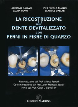 Perni endocanalari in fibra di vetro Wintek Post 3. Radiopaco Perni endocanalari in fibra di vetro Wintek Post 3. Radiopaco