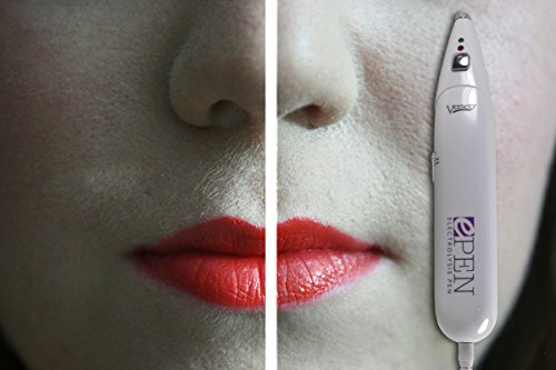 image for Verseo Permanent Hair Removal Conductive Patches for the Body, Leg, St