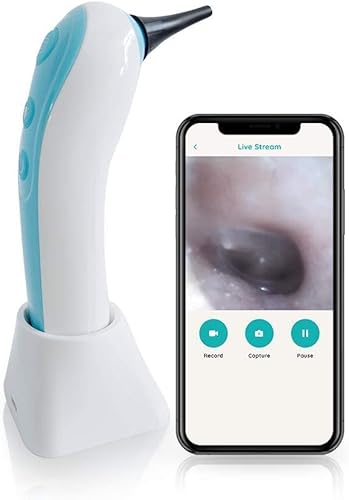 Remmie Dolphin - Otoscopio inalámbrico para oído, otoscopio inalámbrico registrado por la FDA con iPhone, Android y cámara para otorrinolaringología