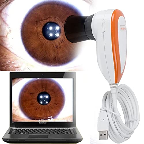 Eye Iridology Camera 5.0 Million Pixel Iris Detector,Usb2.0 Interface Iris Machine HD 30x Iris Lens Analysis Software