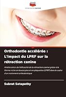 Orthodontie accélérée : L'impact du LPRF sur la rétraction canine (French Edition) 3639865790 Book Cover