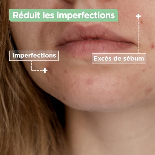 Mixa Anti-Unreinheiten Gesichtspflege- und Reinigungsduo: Salicysäure & Niancinamid Serum 30ml gegen Unreine Haut + Cleanser für zu unreinheiten neidgende Haut 150ml