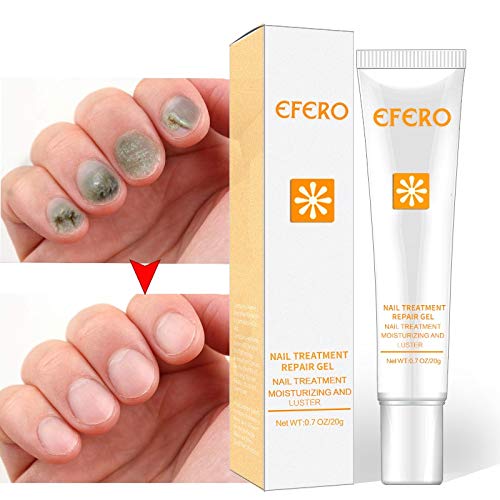 Buy Zzebra Efero Fungus Nails Repair Essence Serum Nail Treatment Remove Onychomycosis Nails And Toes Whitening Toenails Skin Care g Online At Low Prices In India Amazon In