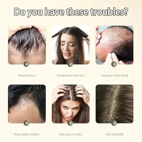 Ginger Anti Hair Loss Shampoo,Haarwachstum Shampoo,Polygonum Multiflorum Ginger Plant Extract Hair Care,Pflanzenextrakt ShampooGegen Haarausfall, Natürlich Bio Anti-Haarausfall