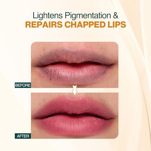 Nourish Mantra Rose Repair Lip Balm with SPF/Made with Rose Extracts, Olive oil, Shea Butter, Vitamin E and Avocado Oil/For Dry, Chapped and Dark Lips/ 12gms