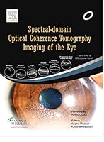 Spectral Domain Optical Coherence Tomography Imaging of the Eye 813123052X Book Cover