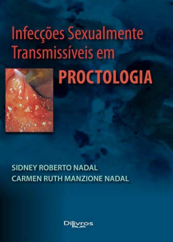 Infecções Sexualmente Transmissíveis em Proctologia - Nadal, Sidney Roberto