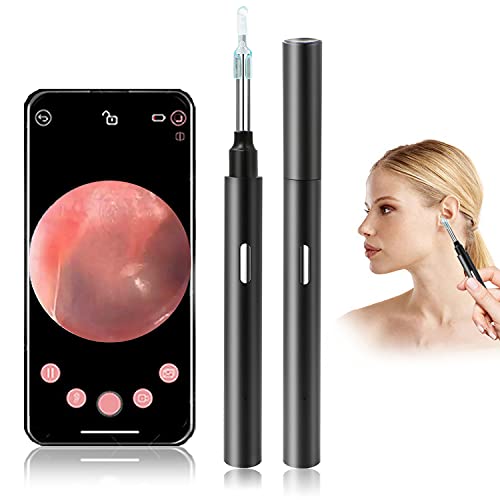 LOOYUAN Ear Wax Removal Endoscope Earwax Remover Tool Wireless Ear Otoscope Ear Camera with 6 LED Lights Ear Scope with Ear Wax Cleaner Tool Visual Ear Endoscope Kit for Kids,Adults,Android,iOS