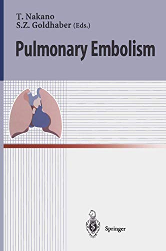 Pulmonary Embolism view 2