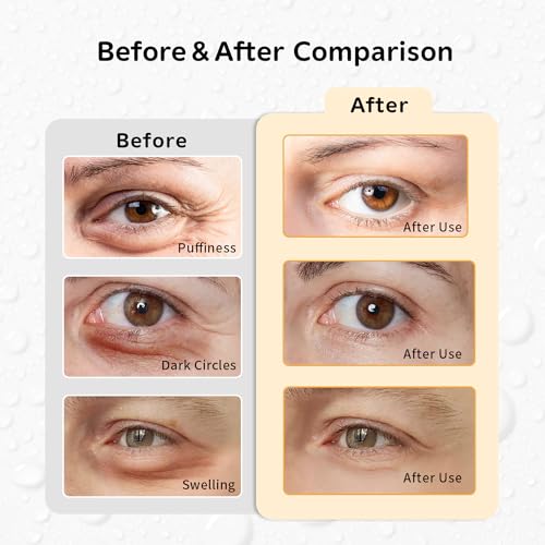 Image of Gel Ice Pack Reusable, Cooling Eye Pads and Patches, Hot and Cold Eye Pads - Soothing, Revitalizing, Puffiness, Refresh, Relieves Stress, Relax, Relieves Puffiness(2 Hedgehogs+2 Red-crowned cranes)