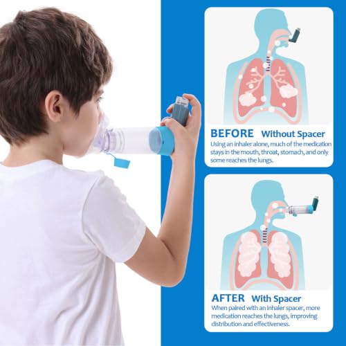 Image of Inhaler Spacer for Children, Nessi OTC Spacer, Spacer for Inhaler with Silicone Mask, Anti-Static Chamber & Exhalation Valve, Easy to Use & Clean
