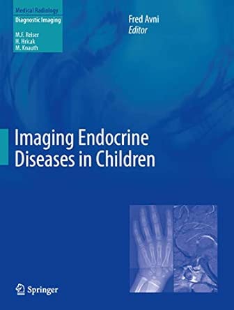 Imaging Endocrine Diseases in Children 2013th Edition book cover