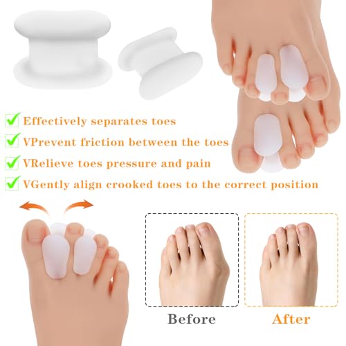 Image of Gjinxi 12 Pack Gel Toe Spacers, Toe Separators for Women Men Bunion Corrector Toe Spreaders Soft Toe Straightener for Crooked Toes, Overlapping Toes, Hammertoe Correction(6L+6S)