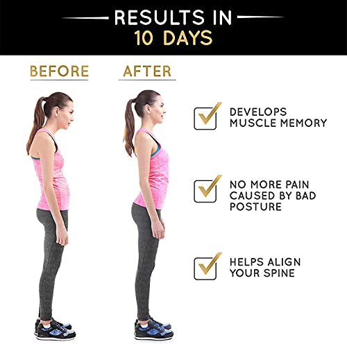 Image of DClub Back Posture Corrector for Women & Men - Effective and Comfortable Posture Brace Discreet Design - Clavicle Support.|FREE SIZE|