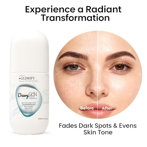 DewySkin Infusion Serum – Niacinamide & Hyaluronic Acid Hydrating Face Serum for Glowing, Plump Skin | Brightening, Moisture-Boosting & Firming Facial Serum for All Skin Types, 30ml