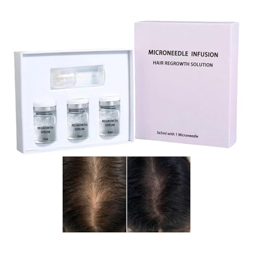 WJnflQN Huile pour la Croissance des Cheveux | Huile Légère pour Cheveux | Hydratant Épaississant Extraits Végétaux Prévention Chute Soin Cuir Chevelu Hommes Adultes Cheveux Fins