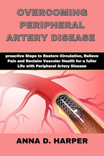 OVERCOMING PERIPHERAL ARTERY DISEASE : Proactive Steps to Restore Circulation, Relieve Pain, and Reclaim Vascular Health for a Fuller Life with Peripheral Artery Disease (English Edition) - Harper, Anna D.