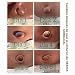 Imagen de Umbilical Cinturón de hernia para bebé con banda para el ombligo
