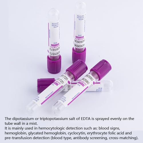 EDTAK2 - Provette sottovuoto per raccolta del sangue, 100 pezzi, 5 ml/10 ml, con tappo a vite viola, per uso in laboratorio