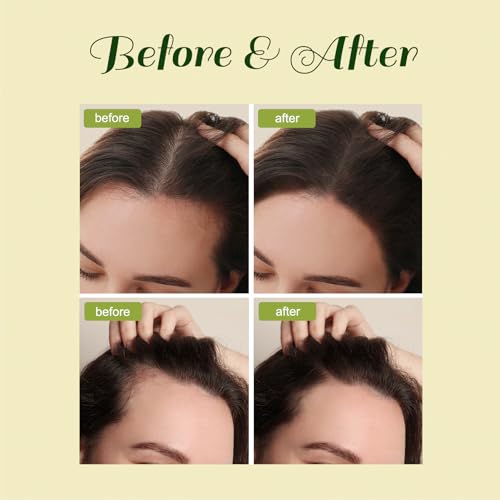 Veganel Hair Growth Oil, Veganel Natural Hair Growth Oil, Veganel Hair Oil for Hair Growth for Men and Women 2pcs - Image 5