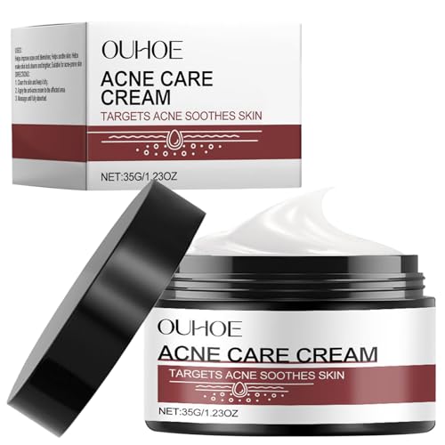 Crema Acne, Crema Granos Cara, Reduce los Puntos Negros y el Acné, para Eliminar Imperfecciones, Mejora la Apariencia de la Piel, para Cara y Glúteos, Espalda y Zona de Los Muslos