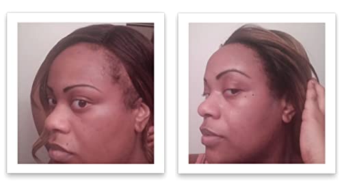 Caboki Hair Building Fiber + Built-in Spray Applicator (30-50 Days Supply). Black