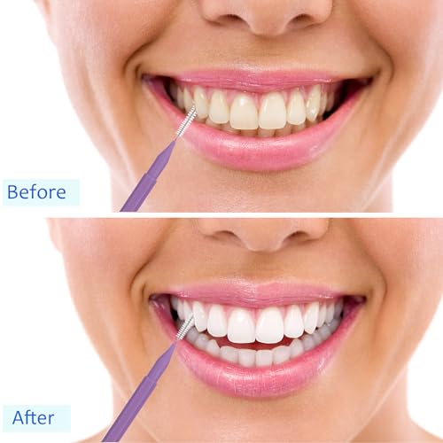 Image of Patelai 100 Pieces Braces Dental Brush for Cleaner Interdental Toothpick Dental Tooth Flossing Head Oral Hygiene Flosser Toothpick Cleaners Tooth Tool(Pink,Purple,Suitable Size)