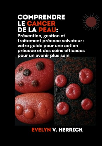 Comprendre le cancer de la peau: Prévention, gestion et traitement précoce salvateur : votre guide pour une action précoce et des soins efficaces pour un avenir plus sain