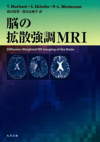 無料電子書籍 おすすめ 脳の拡散強調MRI バイ