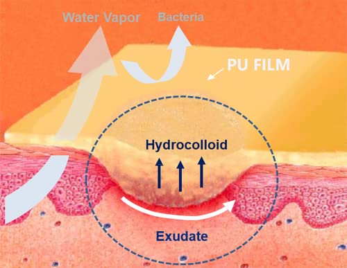 Dimora Hydrocolloid Adhesive Bandage, Hydrocolloid Wound Dressing Thin Type 4'' x 4'', Individually Sterile Packed Hydrocolloid Patches, Box of 10 Dressings