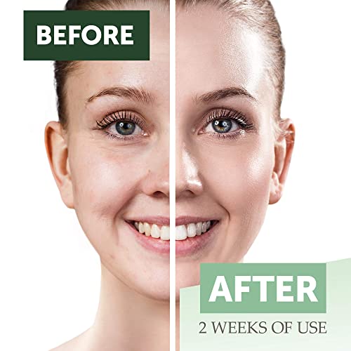 Measurable Difference Collagen + Retinol Serum, 1 Oz - Anti-Aging Face Serum - Strengthen & Moisturize Skin, Restore Elasticity, Help Reduce Wrinkles, Fine Lines #TOP6