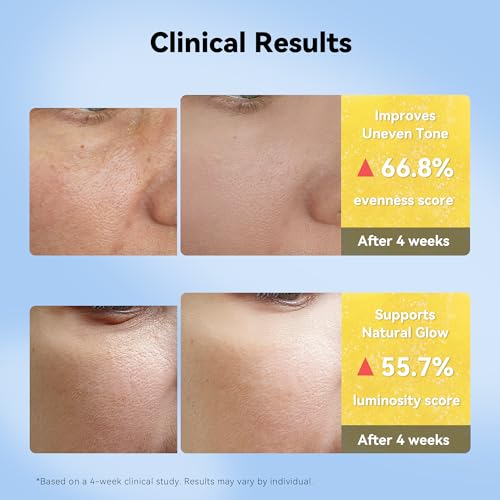 XIANUI Deep Vitamin Radiance Serum - 5% Niacinamide + TXA + Vitamin C - Brightening & Hydrating Face Serum with Ceramide & Triple Hyaluronic Acid for Dull & Uneven-Looking Skin, 1.01 fl.oz — view 5