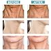 Neck Firming Cream, Neck Tightening Cream, Anti Aging ＆ Wrinkle Neck Cream, Skin Tightening, Helps Double Chin, Turkey Neck Tightener, Repair Crepe Skin