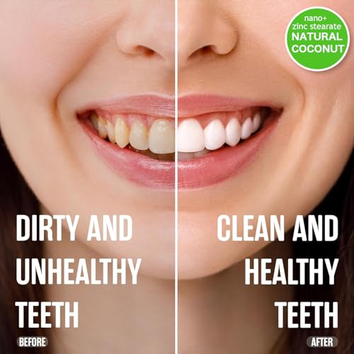 Image of 2-Pack Coconut Mint Oil Toothpaste, Refreshing Mint Flavor, Daily Toothpaste with Zinc Citrate, Fluoride-Free Formula, 4 oz*2