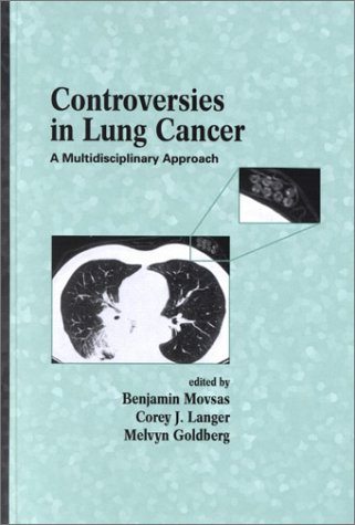 Buy Controversies In Lung Cancer:A Multidisciplinary Approach — BookShops.in