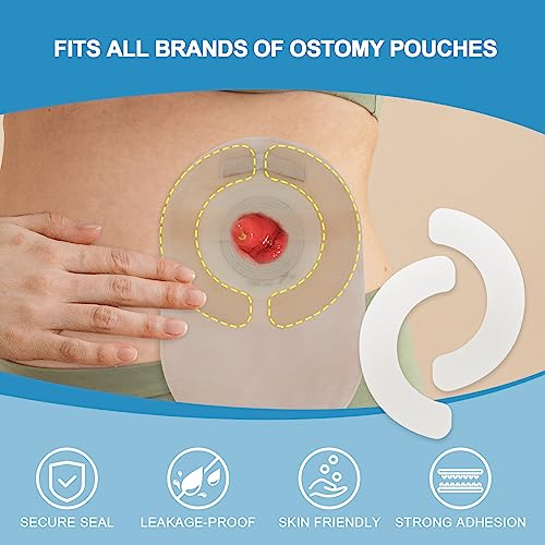 Konweda Ostomy Barrier Strips | Elastic Barrier Strips For Colostomy Bags [Pack Of 10] #TOP1