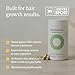 Nutrafol Women's Hair Growth Supplements, for Women 18-44 Years Old, Clinically Tested for Visibly Thicker, Stronger Hair, 100% Vegan Ingredients, Dermatologist Recommended - 2 Month Supply
